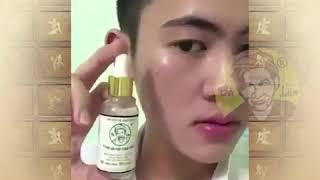 Thuốc trị mụn bà lão có tốt không ?