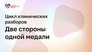 Можем ли сделать клинические рекомендации по ХСН реальной клинической практикой?