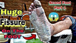 Extreme Dirty Feet Transformation: Deep Pedicure Makeover.|