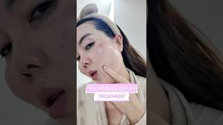 Serum phục hồi sau xâm lấn, laser, treatment, retinol, peel da, sẹo rỗ tại nhà #trinhmeow