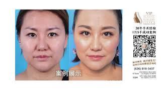 VIP Plastic Surgery | Los Angeles Plastic Surgeon | Dr. Andrew Choi | 洛杉矶名店 | 医疗美容 | 美丽源于自信，更源于专业