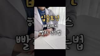 헤르페스 입술물집 하루만에 빨리 낫는 법 (입술포진) #아시클로버 #아시크로버 #포지넨 #티로클 #티로트리신