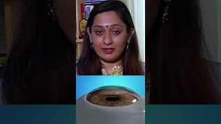 PRK (Photorefractive Keratectomy) Laser Eye Surgery Explained | Dr. Pooja Khamar | Hindi #shorts