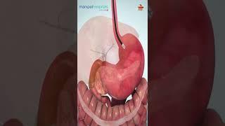 ERCP Procedure Explained | Dr. Pratap Bahera | Manipal Hospital Bhubaneswar
