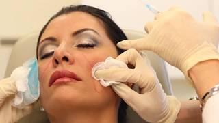 Sculptra Aesthetic | Dermal Filler Injectable | Dr. Carolyn Jacob