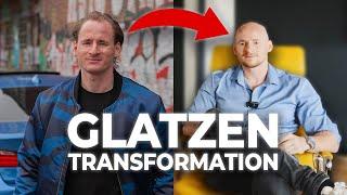   Krasse Transformation: Von Haarausfall zur Glatze bei Andre ‍