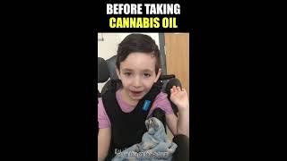 Cannabis Oil Miraculous Recovery in 6 Year Old!