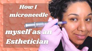 Microneedling | how to microneedle at home with Dr. Pen | esthetician does microneedling