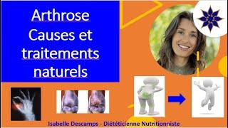 Arthrose : causes et traitements naturels