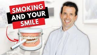 Can a Dentist Tell if you SMOKE  | Dr. Nate