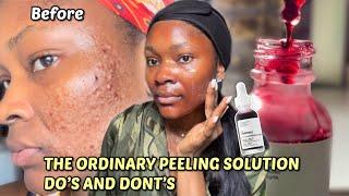 HOW TO PROPERLY USE THE ORDINARY PEELING SOLUTION FOR BEGINNERS | Step by Step Guide