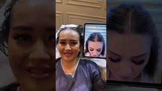 The Ultimate Hair Transformation | Tas Hair Clinic by Dr. Suleyman Tas