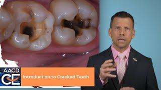 Introduction to Cracked Teeth