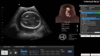 VirtaMed GynoS™ Transabdominal Obstetric Ultrasound Simulator