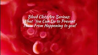 Blood Clots Are Serious: What You Can Do to Prevent Them From Happening to You! @WatersEdgeDerm