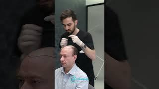 Hair Transplant Surgery