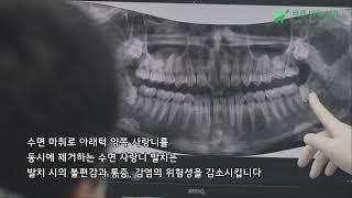 통증 없는 사랑니 발치 평택 소사벌 바른이턱치과