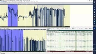 Майстер клас ECGpro Holter 22.06.2023