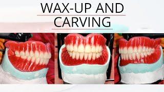 Wax up Carving and feestoning complete denture