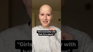 Bald is beautiful! #alopecia #bald #baldisbeautiful #baldgirl