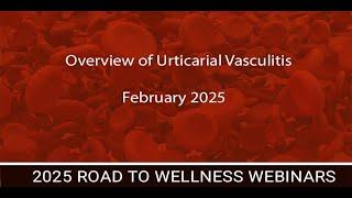 Overview of Urticarial Vasculitis