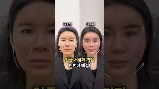 얼굴 처짐과 꺼짐이 고민이라면? 이렇게 해결해드려요
