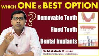 Best Teeth Replacement Options | Fixed Teeth vs Removable Teeth | Eledent Dental Hospitals