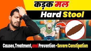 कड़क मल-Hard Stool: Causes,Treatment,and Prevention -Severe Constipation (Vibandha) treatment|Ep.532