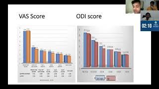 Dr Atif Naseem - Minimally invasive versus open transforaminal lumbar interbody fusion