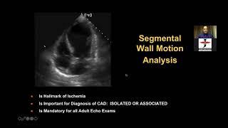 SYSTOLIC FUNCTION BY DR SANJAY MITTAL 14 11 2021