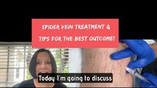 Spider Vein/ Sclerotherapy Treatment - Sharing Tips for the Best Outcome! #spiderveintreatment