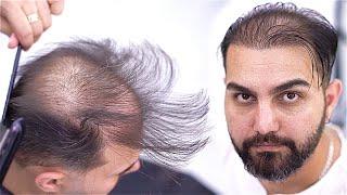 Barber's Magic on a Live Model ‍️ I Transforming Thinning Hair