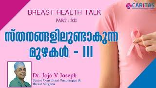 സ്തനങ്ങളിലുണ്ടാകുന്ന മുഴകൾ,Breast Health Talk-Caritas Hospital Surgical Oncologist Dr.jojo V Joseph
