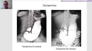 Классическая рентгенологическая диагностика заболеваний желудка. Лектор Бурмистров М.А.