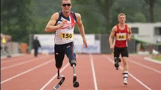 Exploring the Unseen World: 40 Fascinating Facts About Prosthetic Limbs | Cyborgs World