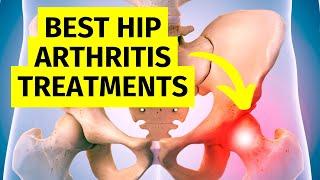 The Best Hip Arthritis Treatments Without Surgery