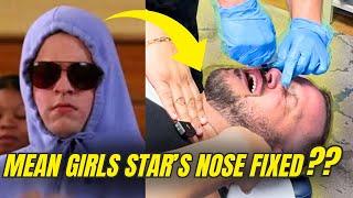 Mean Girls Star Daniel Franzese Gets a Nose Adjustment