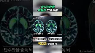  마약만큼 무서운 탄수화물 중독