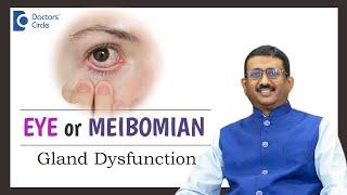 Emerging Treatment for Dry Eye from Meibomian Gland Dysfunction-Dr.Sriram Ramalingam|Doctors' Circle