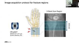 Investigating the complexities of bone adaptation during fracture healing in vivo imaging