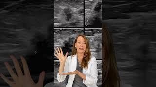 What Does Breast Cancer Look Like on an Ultrasound?