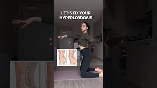 Here’s how you FiX your Hyperlordosis 