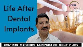 LIFE  AFTER DENTAL IMPLANTS