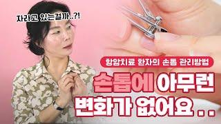 손톱에 아무 변화가 없는데 전 괜찮은 건가요? _ 항암치료 환자의 손톱 관리방법에 대해