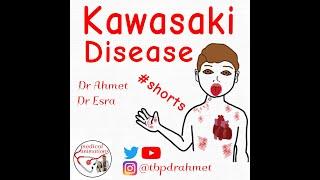 DIAGNOSTIC CRITERIA for KAWASAKI DISEASE | #shorts #pediatrics #cardiology