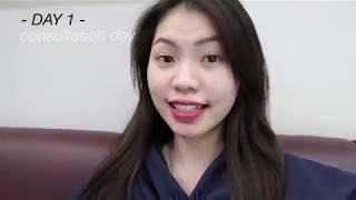 VERONICA ONG COBAIN TREATMENT JERAWAT DI KOREA!!