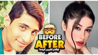 Before & After ️ عکس های دوران بلوغ و الان شما