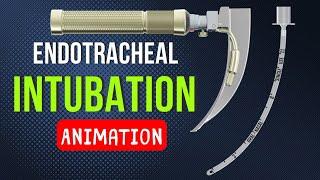 ENDOTRACHEAL INTUBATION | ANIMATION | PEDIATRICS