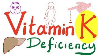 Vitamin K Deficiency - Hemorrhagic Disease of the Newborn (HDN)