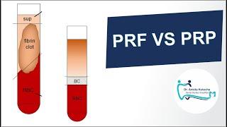 PLATELET RICH PLASMA (PRP) vs PLATELET RICH FIBRIN (PRF)/SUMMARY/PROPERTIES/TECHNIQUE/ DR. ANKITA